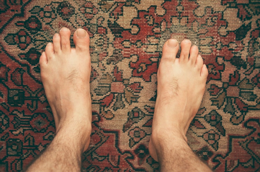Photo swollen feet
