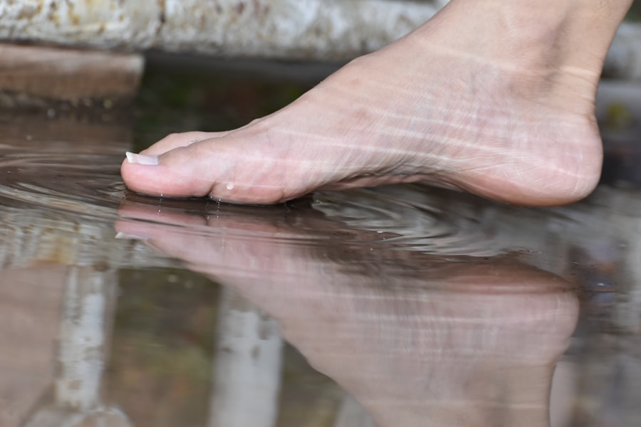 Photo peeling feet